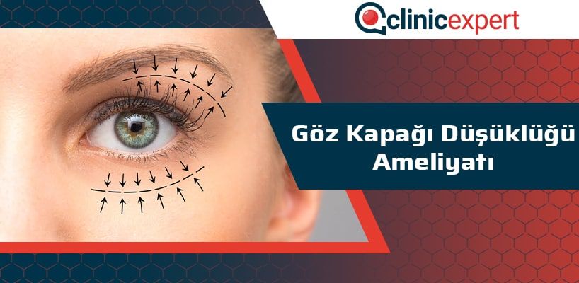 Göz Kapağı Düşüklüğü Ameliyatı