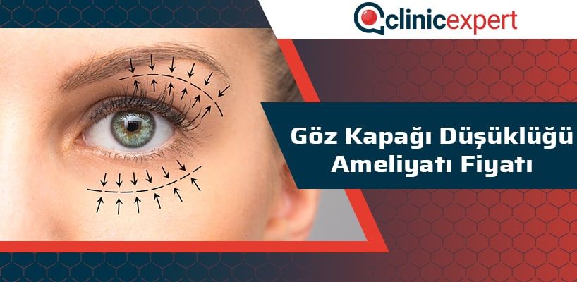 Göz Kapağı Düşüklüğü Ameliyatı Fiyatı