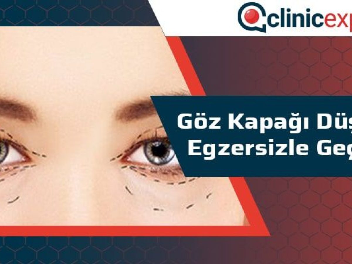 Goz Kapagi Dusuklugu Egzersizle Gecer Mi Goz Kapagi Dusuklugu Egzersizle Gecer Mi