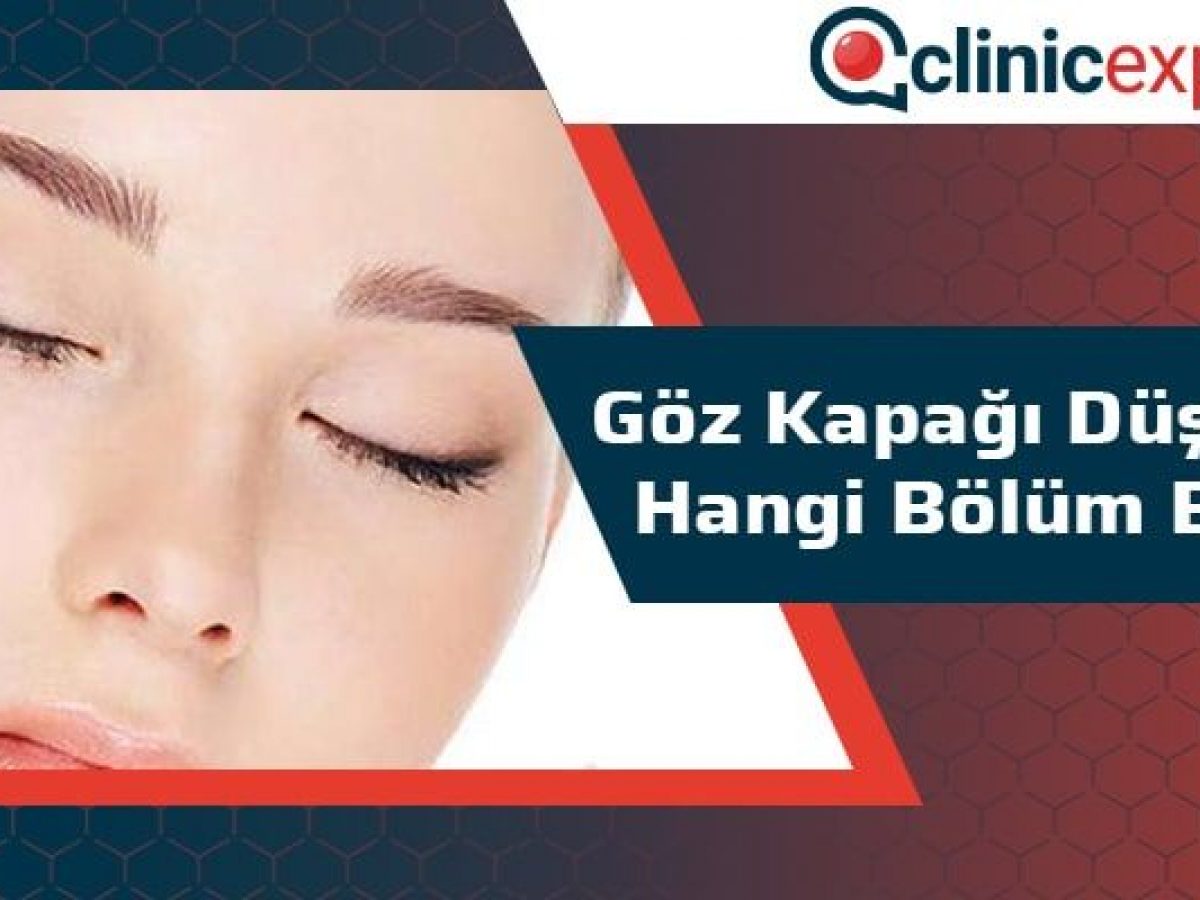 Goz Kapagi Dusuklugu Hangi Bolum Bakar Clinicexpert