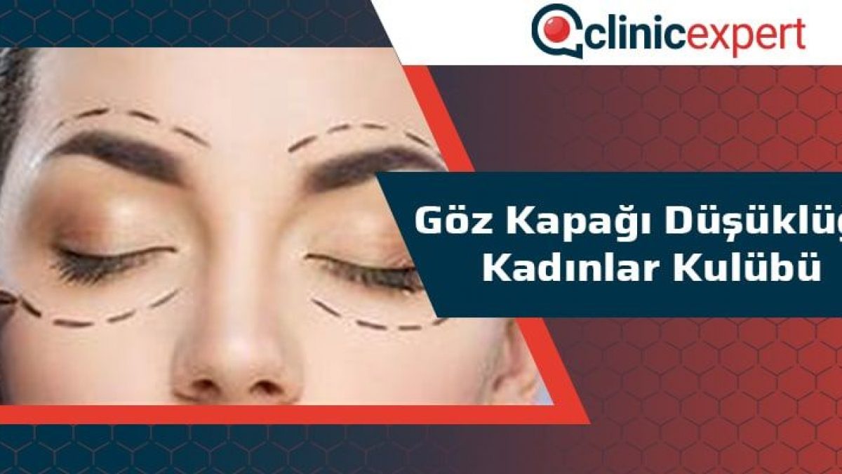 goz kapagi dusuklugu kadinlar kulubu