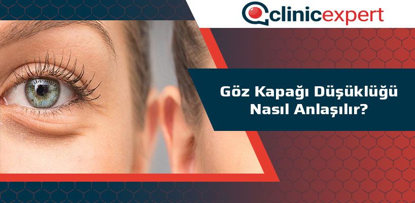 Göz Kapağı Düşüklüğü Nasıl Anlaşılır?