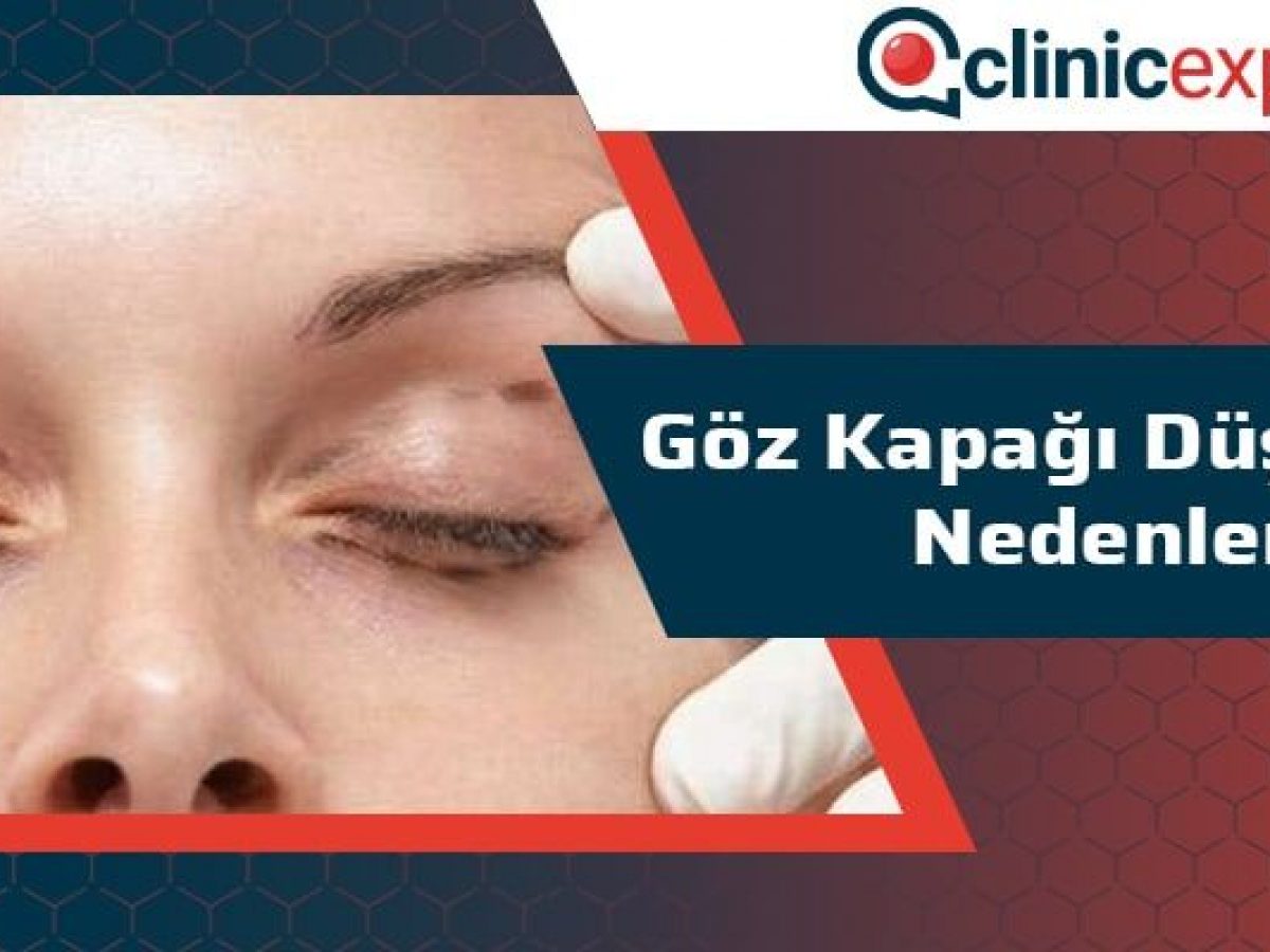 tek taraflı göz kapağı düşüklüğü nedenleri