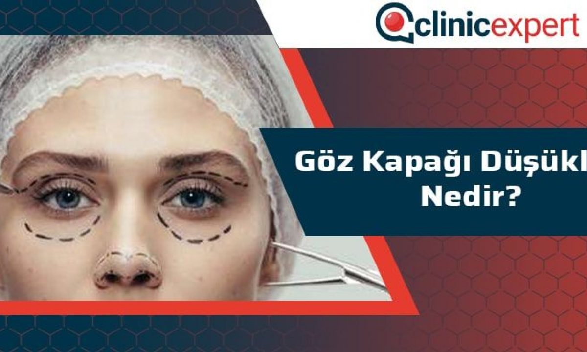 Goz Kapagi Dusuklugu Nedir Clinicexpert Uluslararasi Saglik Hizmetleri