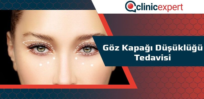 Göz Kapağı Düşüklüğü Tedavisi