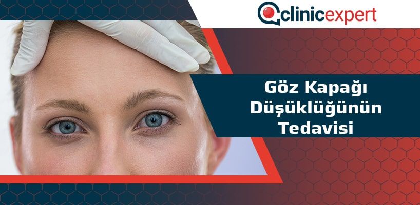 Göz Kapağı Düşüklüğünün Tedavisi