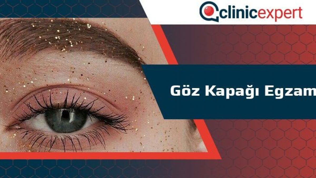 Goz Kapagi Egzama Clinicexpert Uluslararasi Saglik Hizmetleri