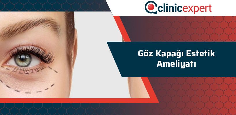 Göz Kapağı Estetik Ameliyatı