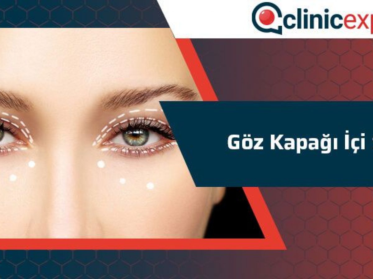 Goz Kapagi Ici Sivilce Clinicexpert Estetik Merkezi