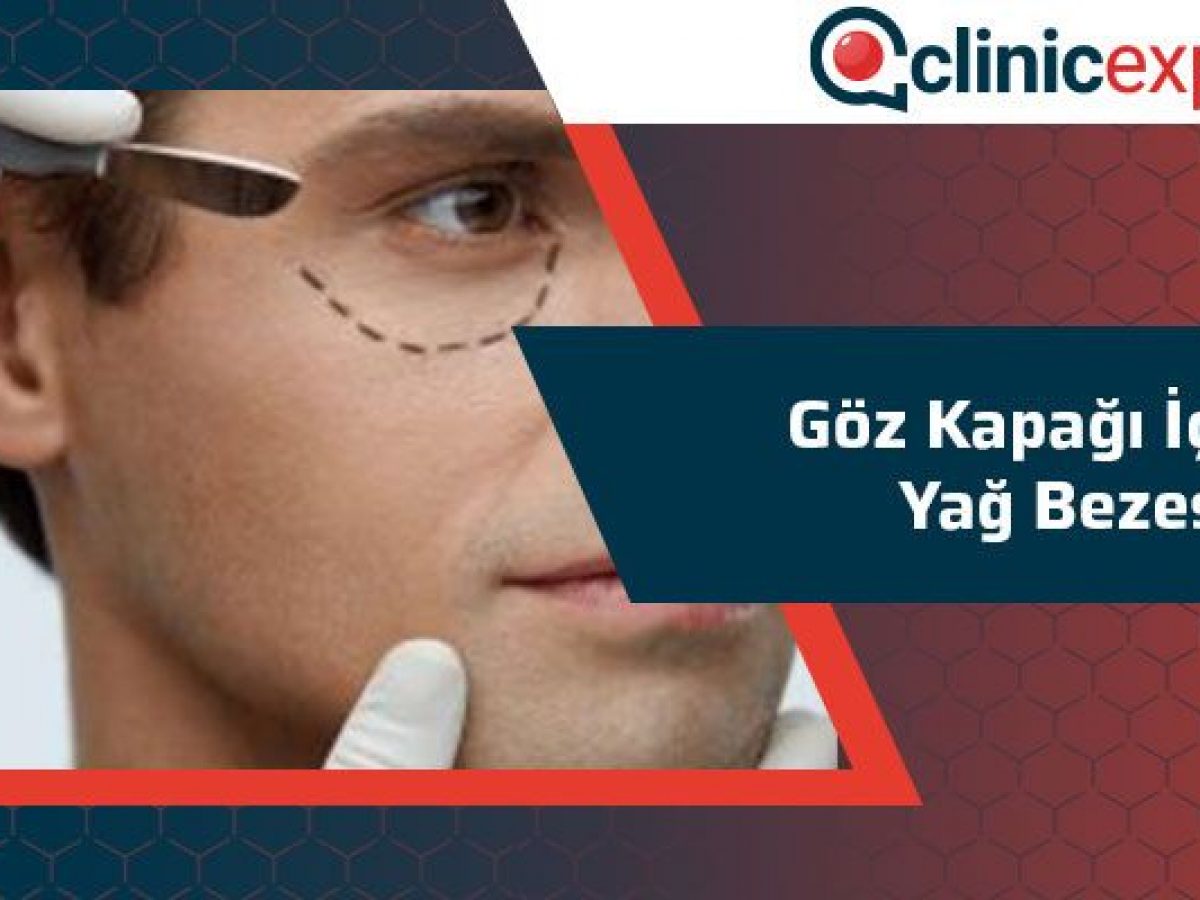 Goz Kapagi Icinde Yag Bezesi Clinicexpert Uluslararasi Saglik Hizmetleri