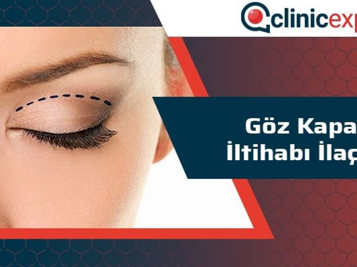 Goz Kapagi Iltihabi Ilaclari Clinicexpert Uluslararasi Saglik Hizmetleri Goz Kapagi Iltihabi Ilaclari Clinicexpert Uluslararasi Saglik Hizmetleri