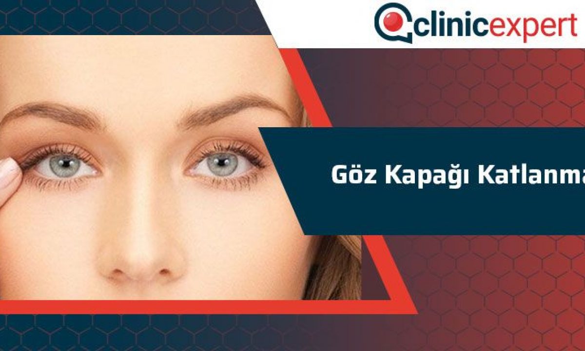 Goz Kapagi Katlanmasi Clinicexpert Uluslararasi Saglik Hizmetleri