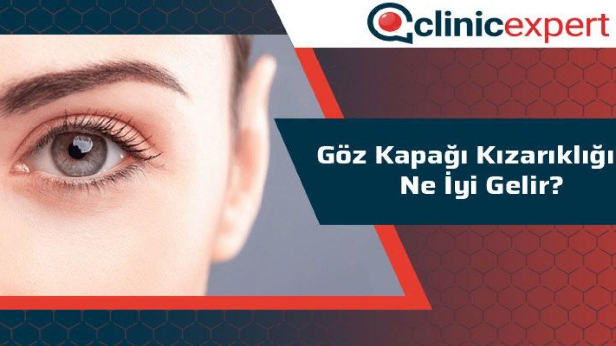 Goz Kapagi Kizarikligina Ne Iyi Gelir