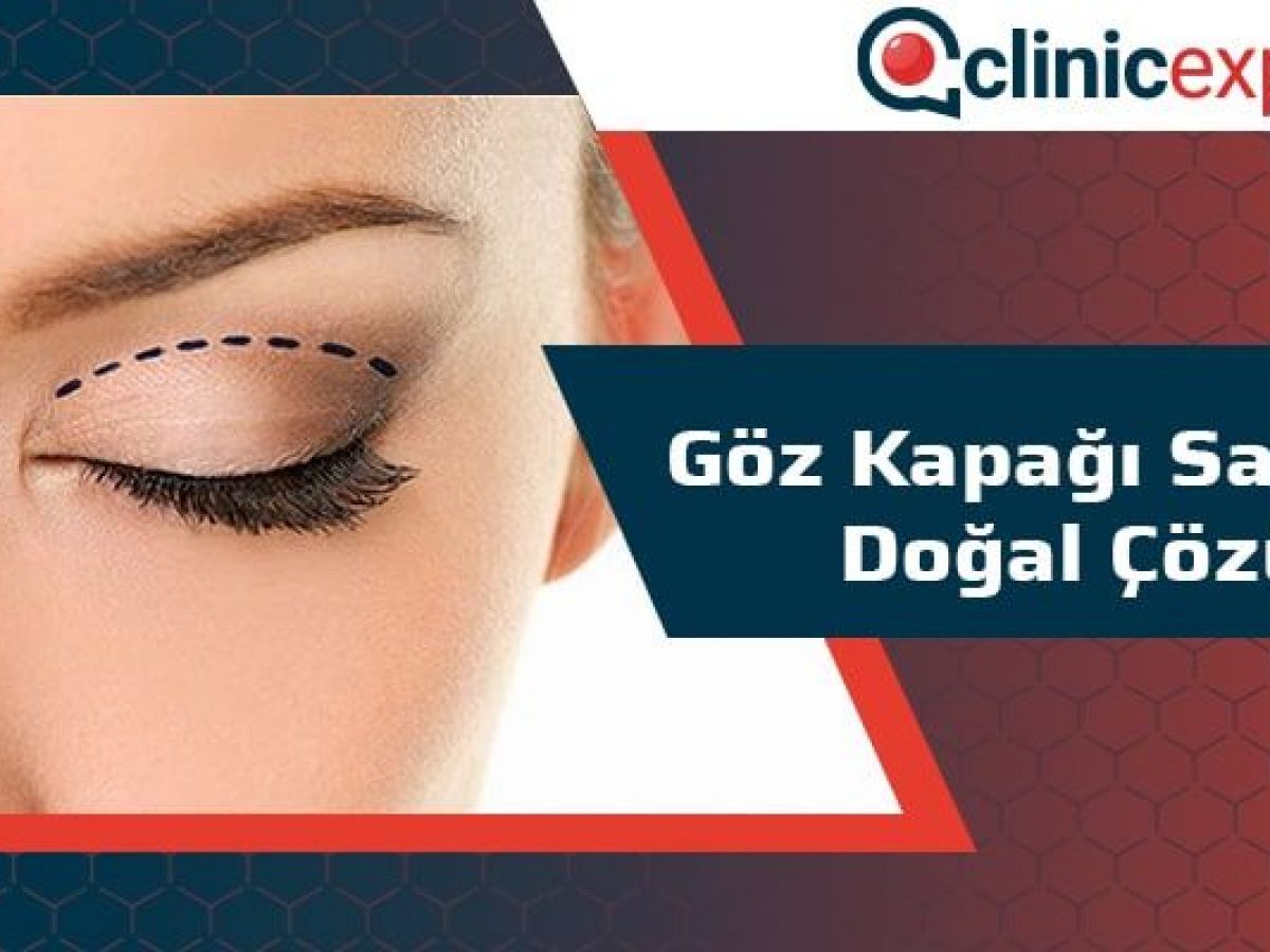 Goz Kapagi Sarkmasi Dogal Cozum