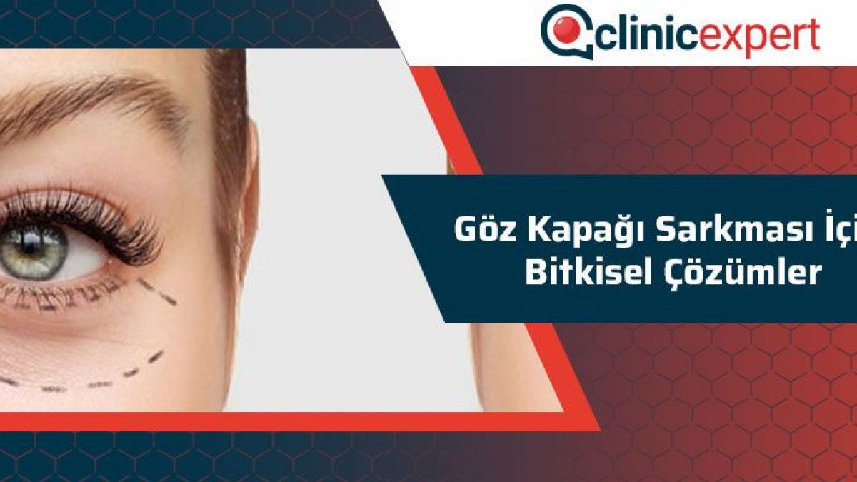 Goz Kapagi Sarkmasi Icin Bitkisel Cozumler
