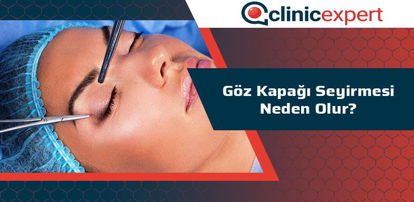 Goz Kapagi Segirmesi Neden Olur Goz Kapagi Segirmesi Neden Olur