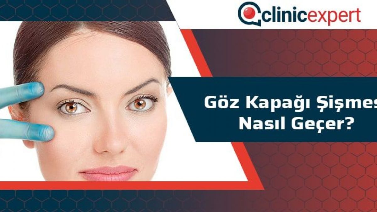 Goz Kapagi Sismesi Nasil Gecer Goz Kapagi Sismesi Nasil Gecer