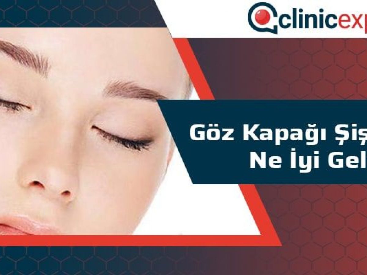 Goz Kapagi Sismesine Ne Iyi Gelir Goz Kapagi Sismesine Ne Iyi Gelir