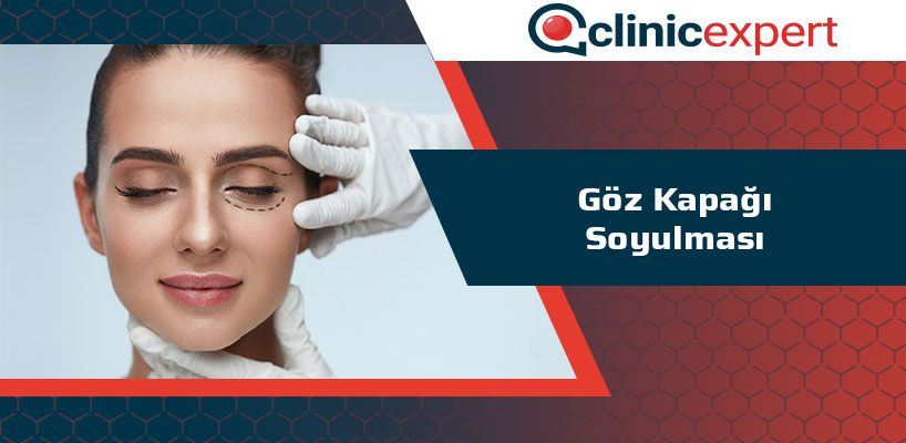 Goz Kapagi Soyulmasi Clinicexpert Uluslararasi Saglik Hizmetleri