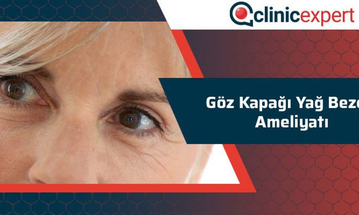 Goz Kapagi Ustunde Yag Bezesi Clinicexpert Estetik