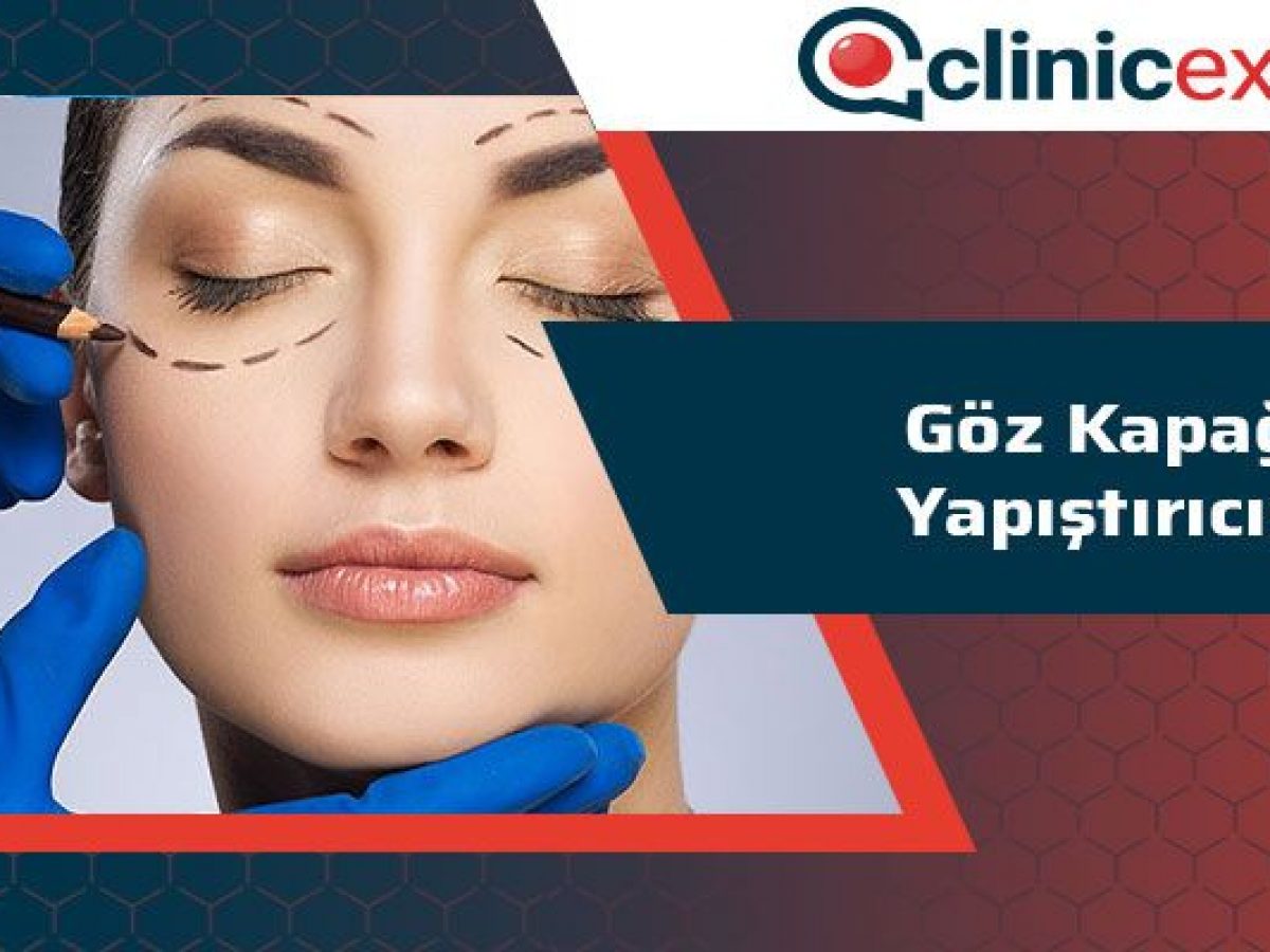 Goz Kapagi Yapistiricisi Clinicexpert Uluslararasi Saglik Hizmetleri