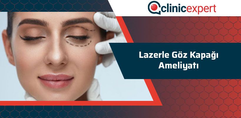 Lazerle Göz Kapağı Ameliyatı