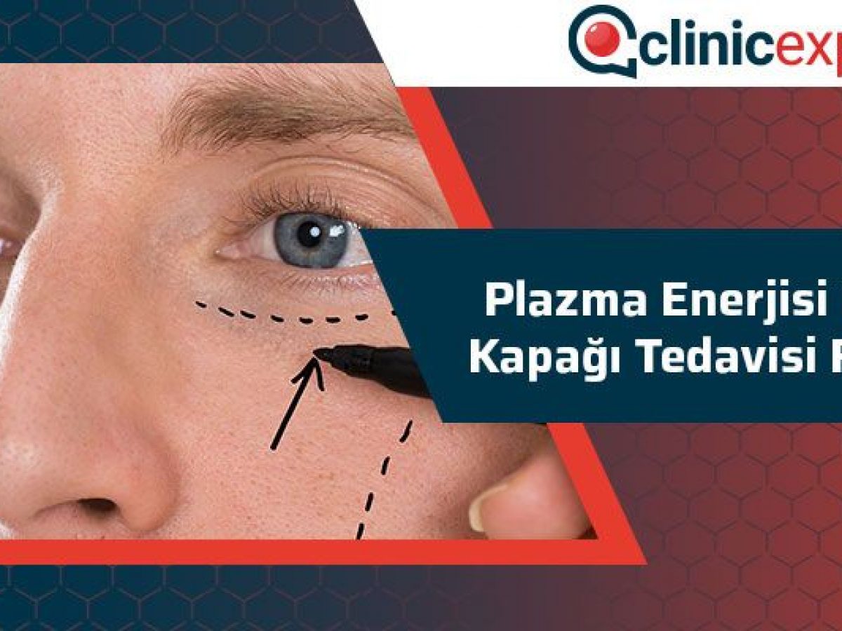 Plazma Enerjisi Ile Goz Kapagi Tedavisi Fiyatlari Plazma Enerjisi Ile Goz Kapagi Tedavisi Fiyatlari