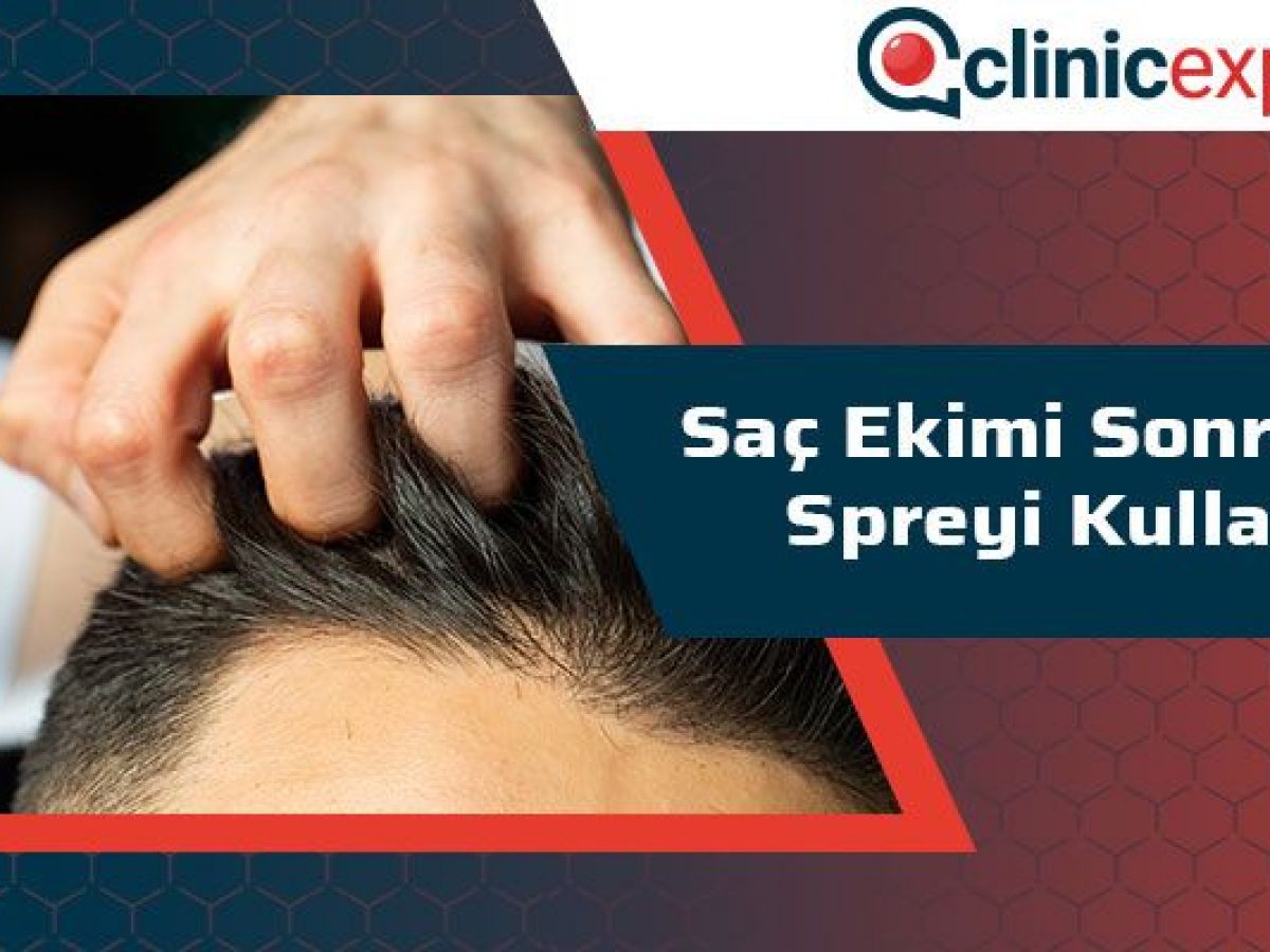 Sac Ekimi Sonrasi Sac Spreyi Kullanimi Clinicexpert Com