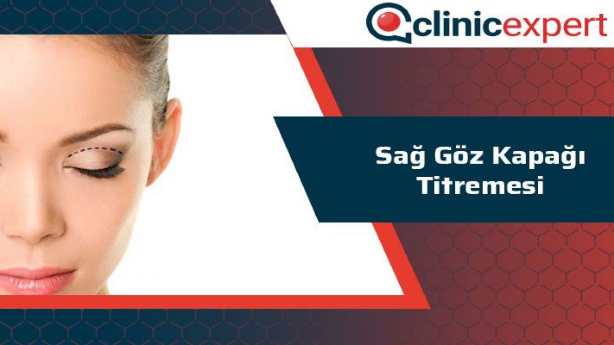 Sag Goz Kapagi Titremesi Clinicexpert Uluslararasi Saglik Hizmetleri