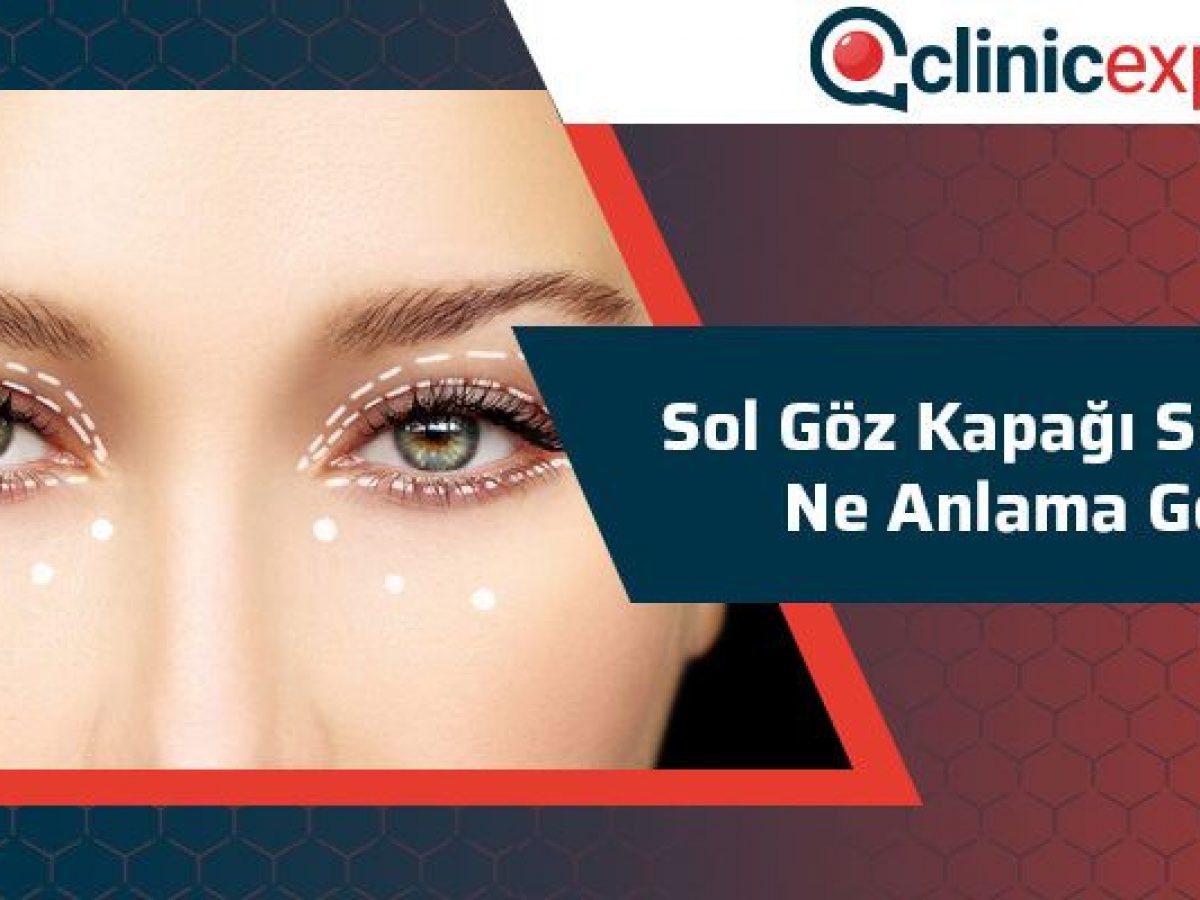 Sol Goz Kapagi Segirmesi Ne Anlama Gelir
