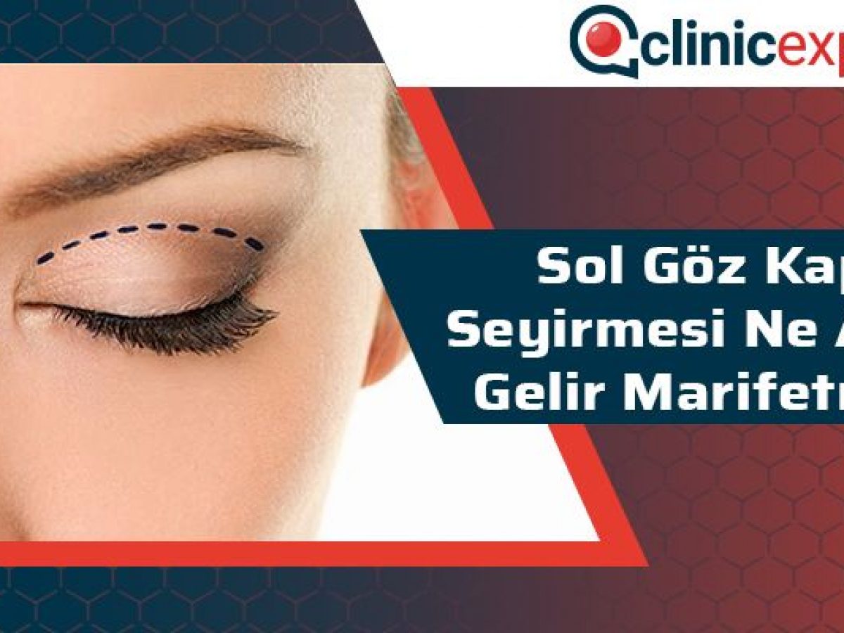 göz seyirmesinin sebebi nedir