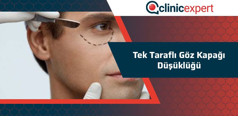 Tek Taraflı Göz Kapağı Düşüklüğü