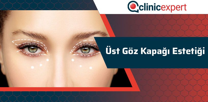 Üst Göz Kapağı Estetiği Nedir