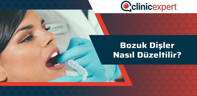 Bozuk Dişler Nasıl Düzeltilir?