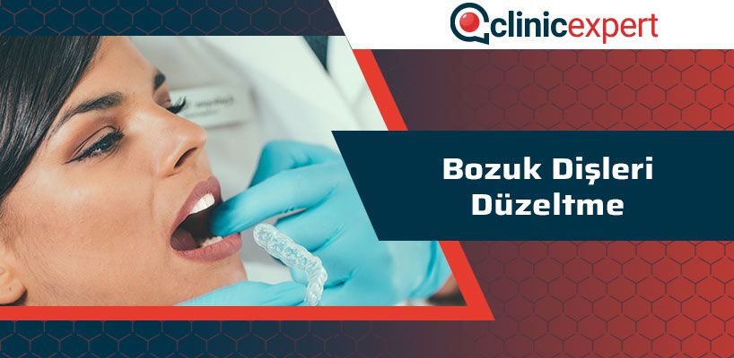 bozuk-disleri-duzeltme-cln