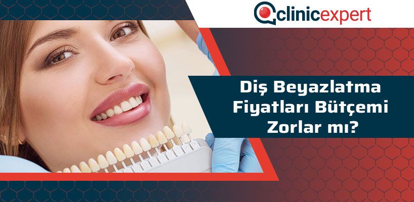 Diş Beyazlatma Fiyatları Bütçemi Zorlar Mı?