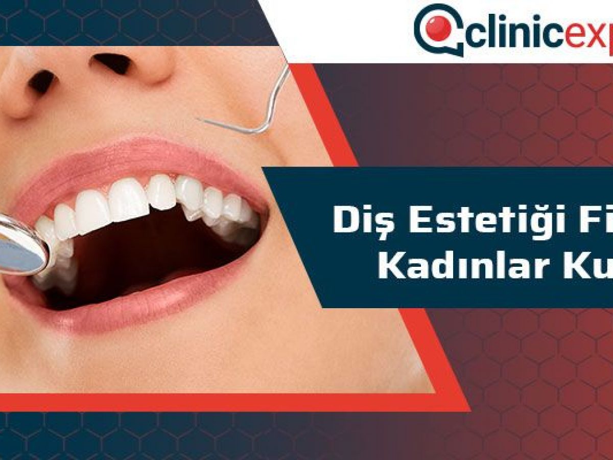 dis estetigi fiyatlari kadinlar kulubu