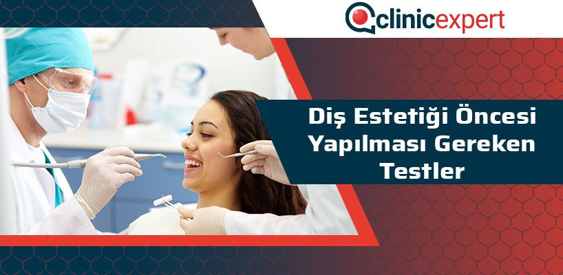 Diş Estetiği Öncesi Yapılması Gereken Testler