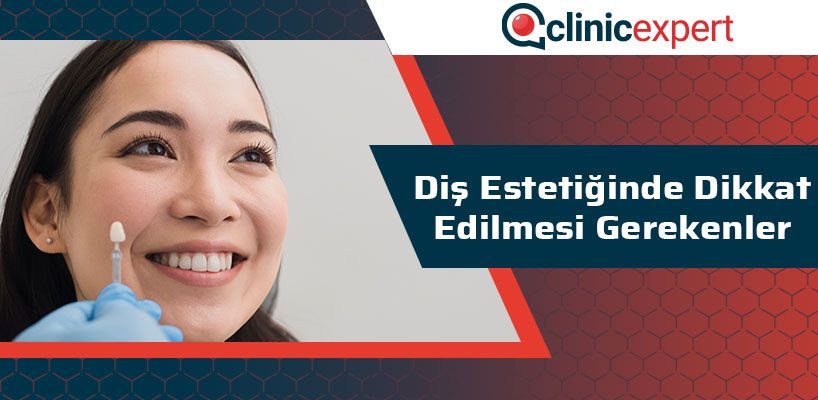 Diş Estetiğinde Dikkat Edilmesi Gerekenler