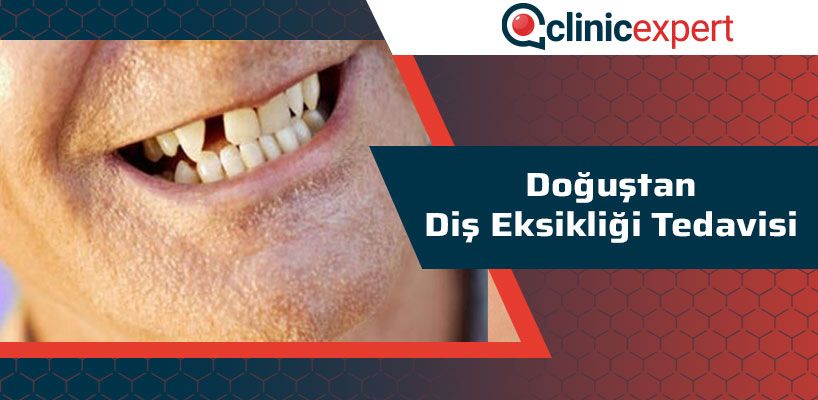 Doğuştan Diş Eksikliği Tedavisi