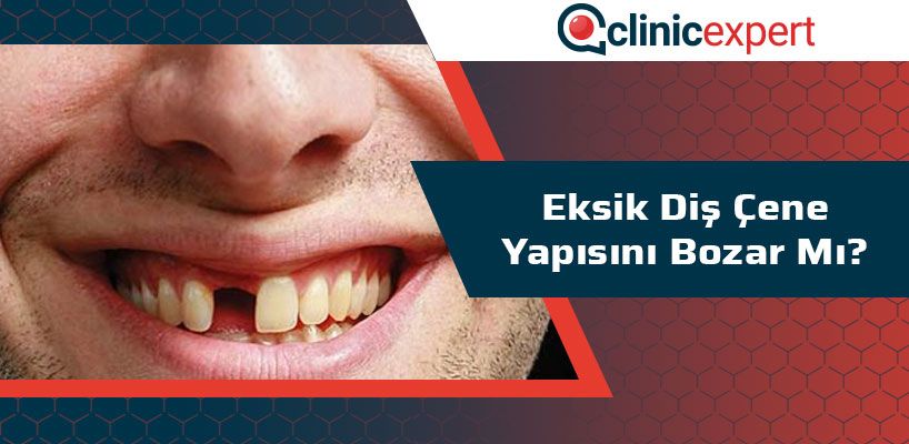 Eksik Diş Çene Yapısını Bozar Mı?