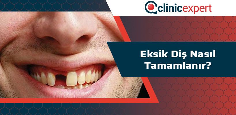 Eksik Diş Nasıl Tamamlanır?