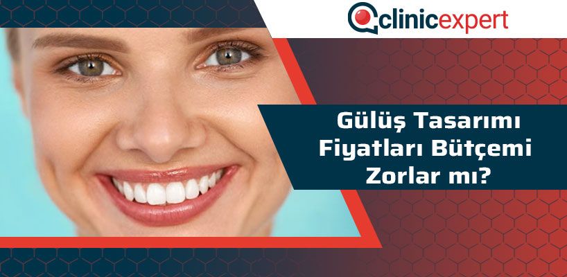 Gülüş Tasarımı Fiyatları Bütçemi Zorlar Mı?