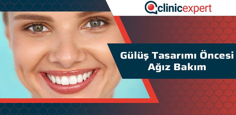 Gülüş Tasarımı Öncesi Ağız Bakım