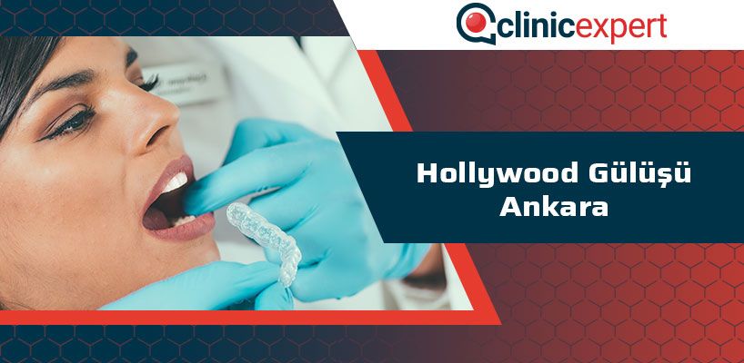 Hollywood Gülüşü Ankara
