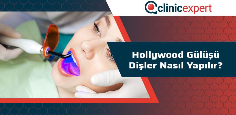 Hollywood Gülüşü Dişler Nasıl Yapılır?