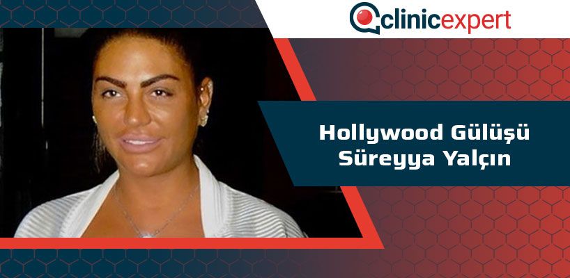 Hollywood Gülüşü Süreyya Yalçın