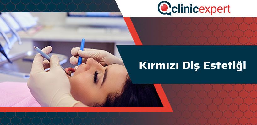 Kırmızı Diş Estetiği