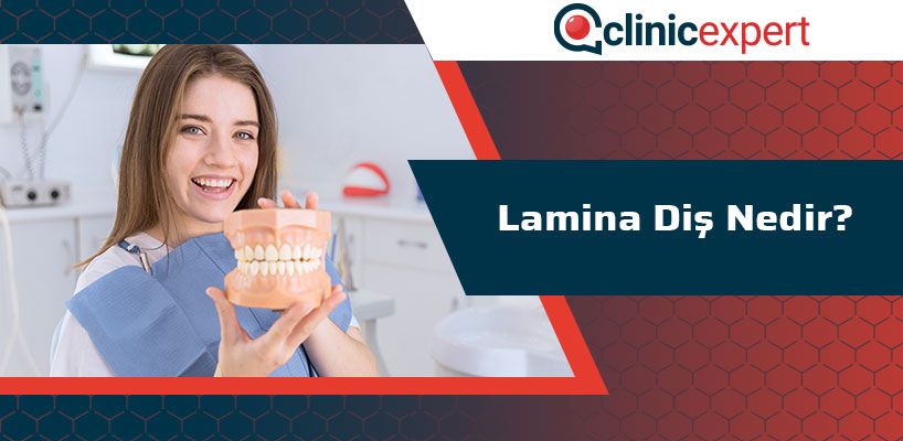 Lamina Diş Nedir?