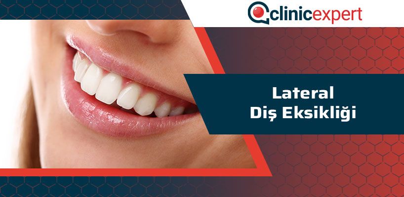 Lateral Diş Eksikliği